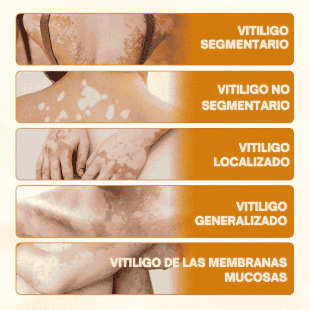 Oveallgo® VitiClear Pro Crema de veneno de abeja Universal