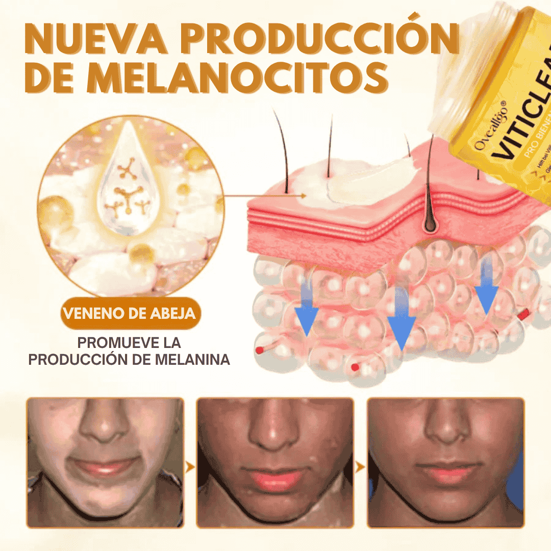 Oveallgo® VitiClear Pro Crema de veneno de abeja Universal