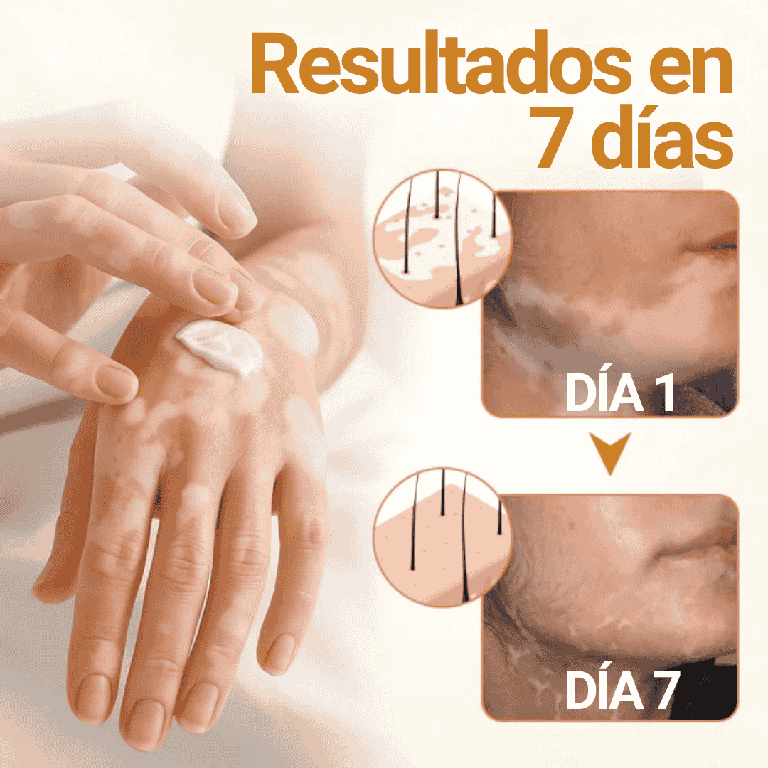 Oveallgo® VitiClear Pro Crema de veneno de abeja Universal