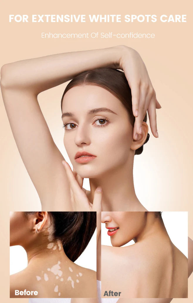 Oveallgo® VitiClear Pro Crema de veneno de abeja Universal