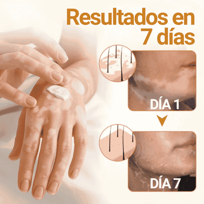 Oveallgo® VitiClear Pro Crema de veneno de abeja Universal